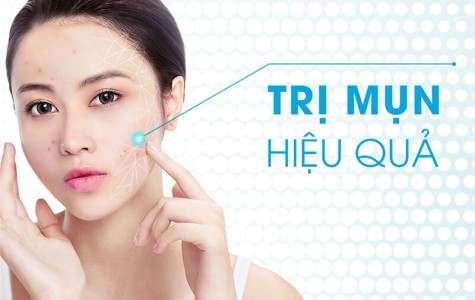 3 Cách trị mụn thâm nhanh nhất tại nhà 