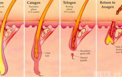 Những Kiến Thức Cần Biết Về Công Nghệ Triệt Lông IPL 
